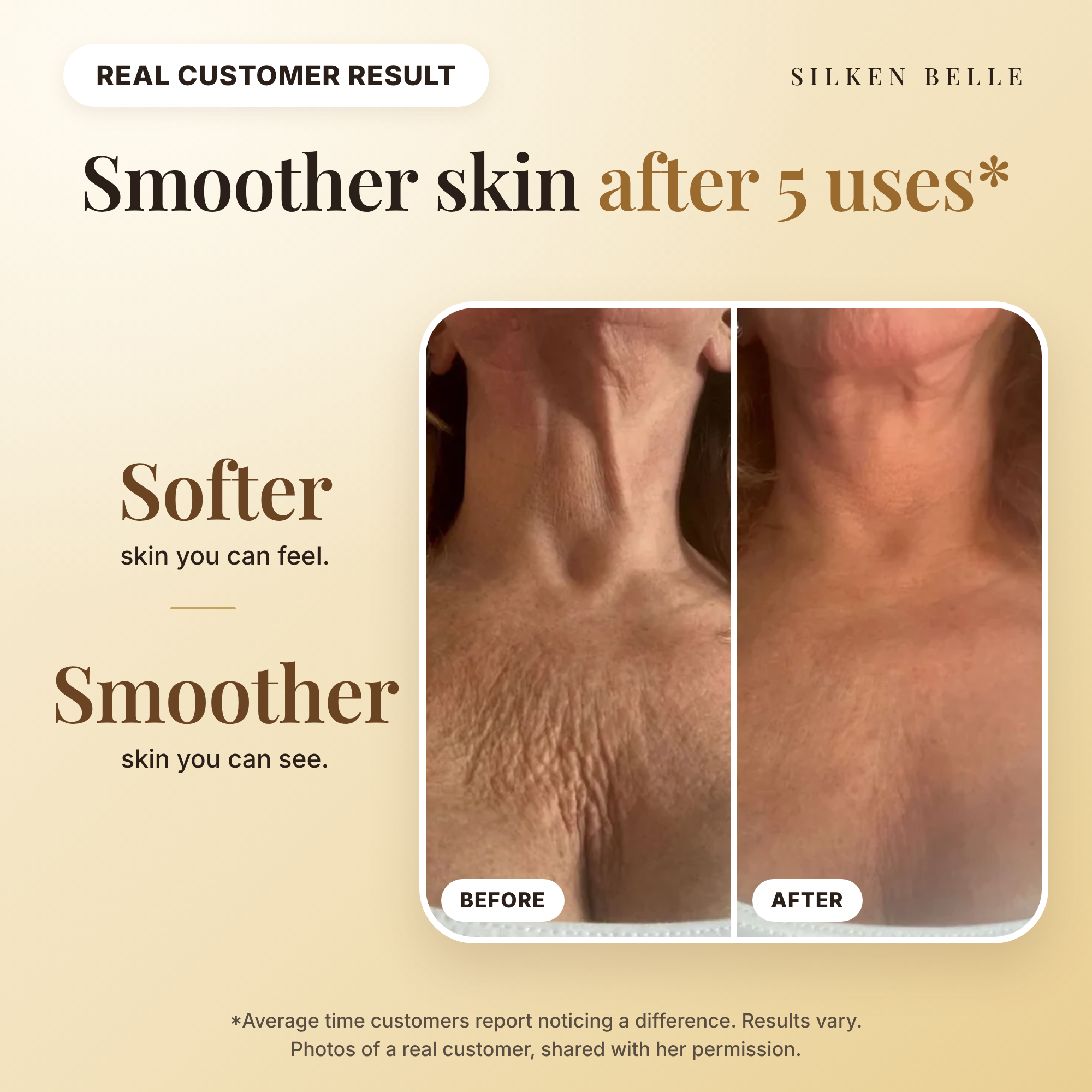 Before and after photos of a real customer's neck and chest after using Silken Belle body oil
